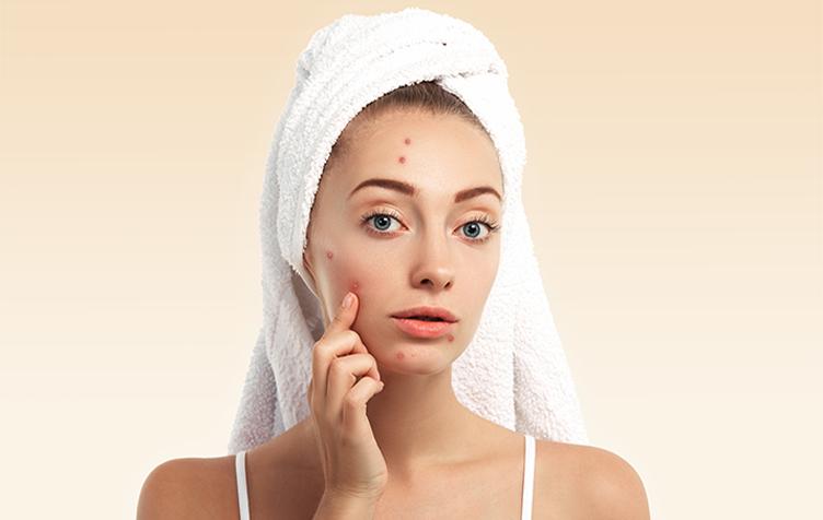Acne Removal